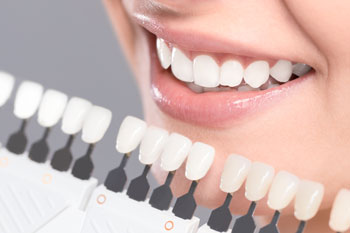 teeth-whitening-charts